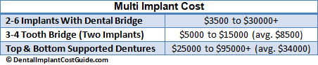 Average Multi Implant Cost