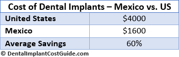 Cost of Dental Implants in US vs. Mexico