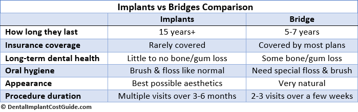 Bridges vs Implants Comparison