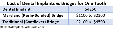 Cost of Implants vs. Bridges