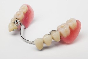 Partial Dentures